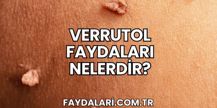 Verrutol Faydaları Nelerdir?