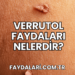 Verrutol Faydaları Nelerdir?