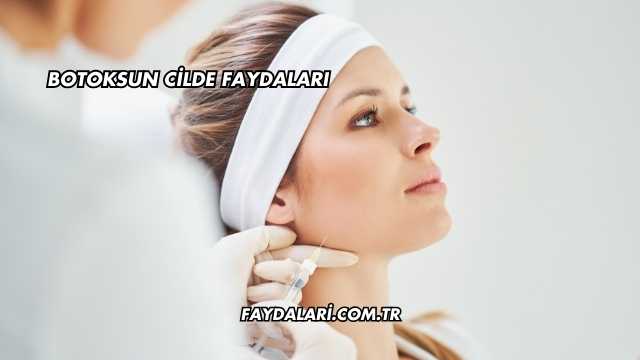 Botoksun Cilde Faydaları
