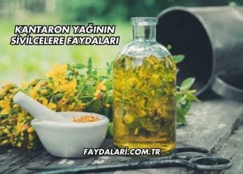 Kantaron Yağının Sivilcelere Faydaları
