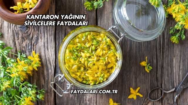 Kantaron Yağının Sivilcelere Faydaları
