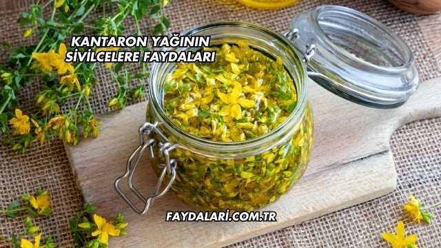 Kantaron Yağının Sivilcelere Faydaları