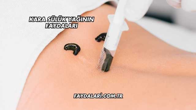 Kara Sülük Yağının Faydaları