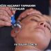 Yüze Hacamat Yapmanın Faydaları