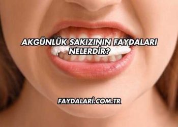 Akgünlük Sakızının Faydaları Nelerdir?