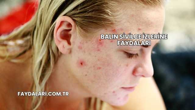 Balın Sivilce İzlerine Faydaları