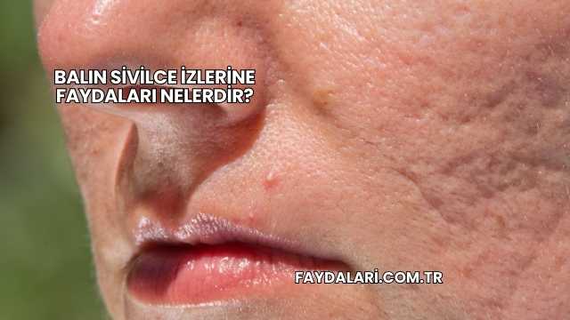 Balın Sivilce İzlerine Faydaları Nelerdir?
