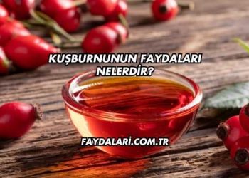 Kuşburnunun Faydaları Nelerdir?