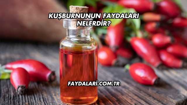 Kuşburnunun Faydaları Nelerdir?