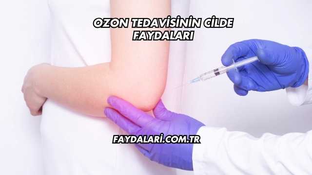 Ozon Tedavisinin Cilde Faydaları
