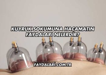 Kuyruk Sokumuna Hacamatın Faydaları Nelerdir?