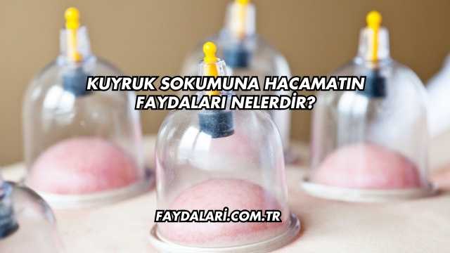 Kuyruk Sokumuna Hacamatın Faydaları Nelerdir?