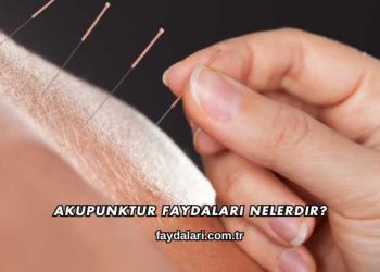 Akupunktur Faydaları Nelerdir?