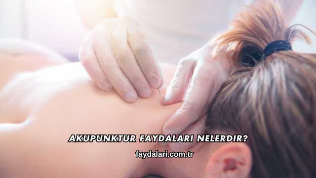 Akupunktur Faydaları Nelerdir?