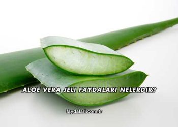 Aloe Vera Jeli Faydaları Nelerdir?