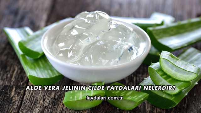 Aloe Vera Jelinin Cilde Faydaları Nelerdir?
