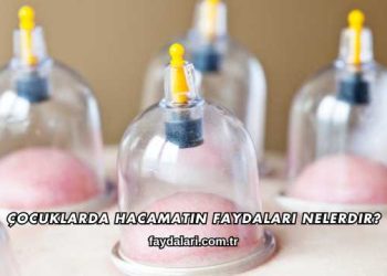 Çocuklarda Hacamatın Faydaları Nelerdir?