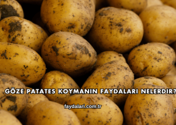 Göze Patates Koymanın Faydaları Nelerdir?