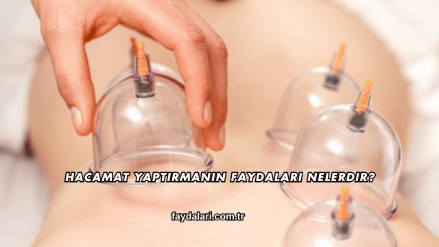 Hacamat Yaptırmanın Faydaları Nelerdir?