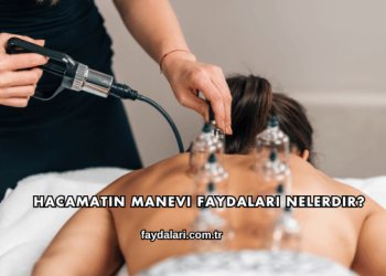 Hacamatın Manevi Faydaları Nelerdir?