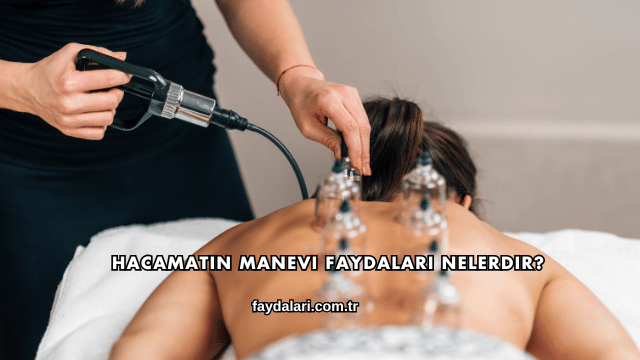 Hacamatın Manevi Faydaları Nelerdir?
