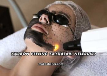 Karbon Peeling Faydaları Nelerdir?