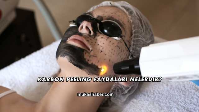 Karbon Peeling Faydaları Nelerdir?