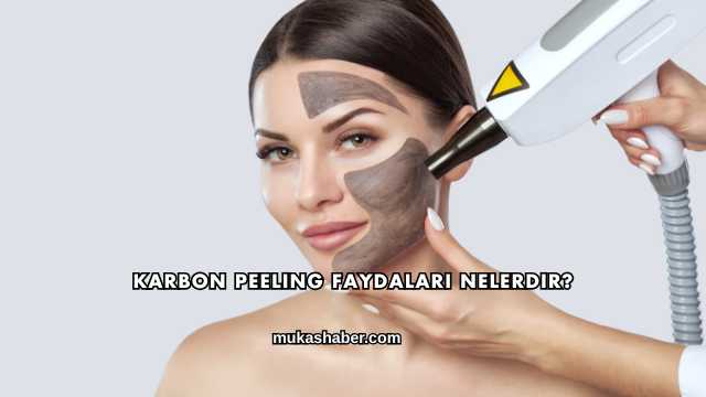 Karbon Peeling Faydaları Nelerdir?