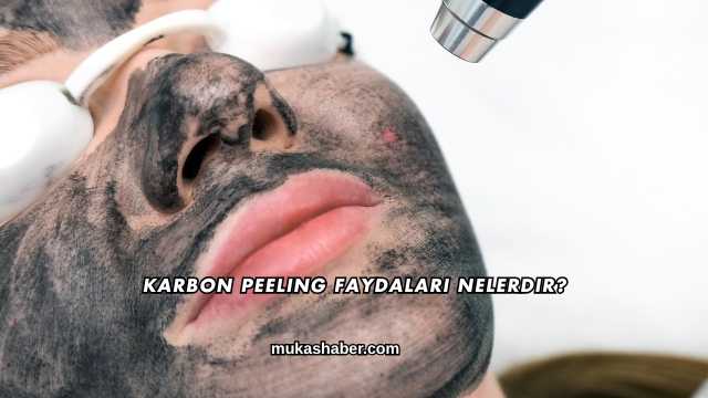 Karbon Peeling Faydaları Nelerdir?