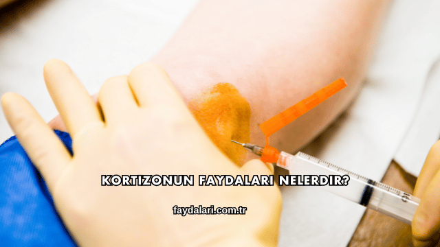 Kortizonun Faydaları Nelerdir?