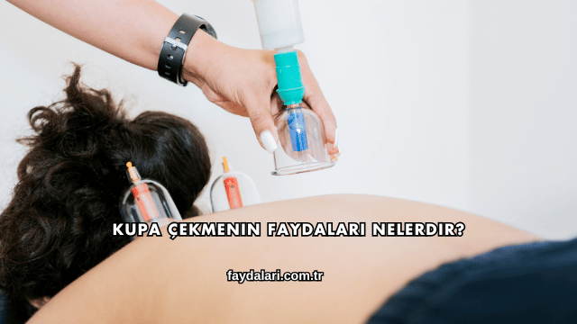Kupa Çekmenin Faydaları Nelerdir?