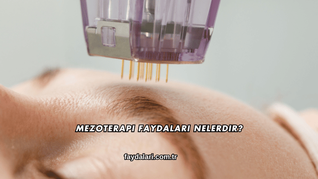 Mezoterapi Faydaları Nelerdir?