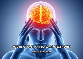 Migren Taşı Faydaları Nelerdir?