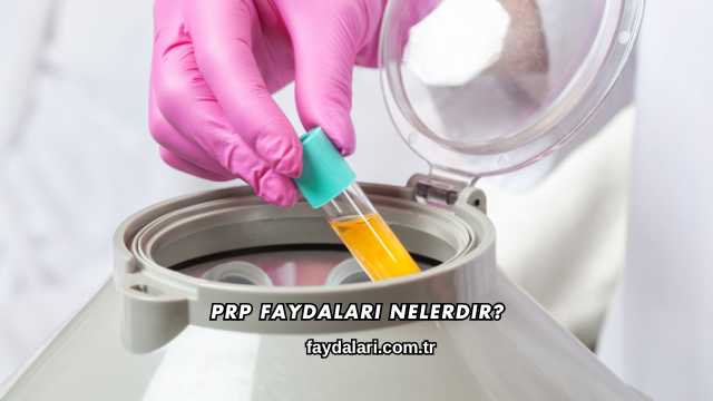 PRP Faydaları Nelerdir?
