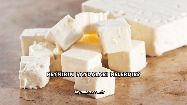 Peynirin Faydaları Nelerdir?