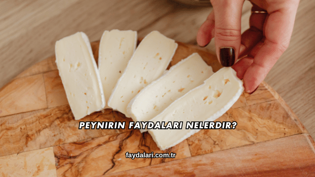 Peynirin Faydaları Nelerdir?