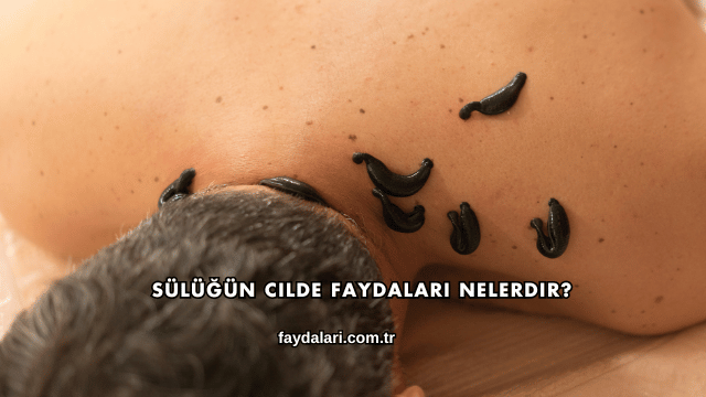 Sülüğün Cilde Faydaları Nelerdir?