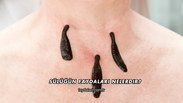 Sülüğün Faydaları Nelerdir?