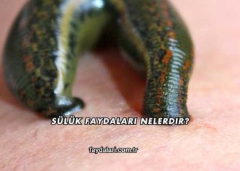 Sülük Faydaları Nelerdir?