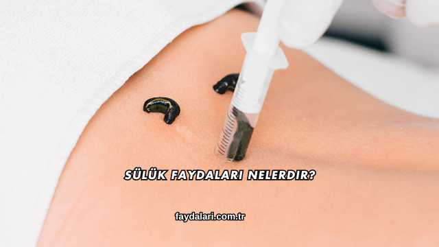 Sülük Faydaları Nelerdir?