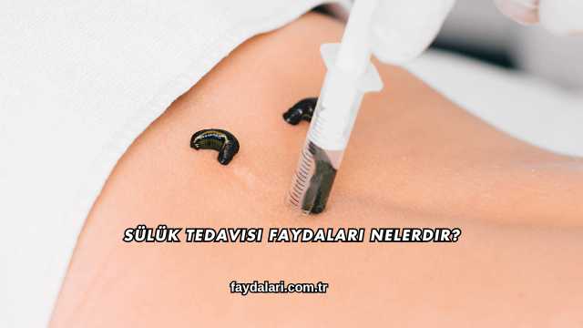 Sülük Tedavisi Faydaları Nelerdir?