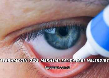 Terramycin Göz Merhemi Faydaları Nelerdir?
