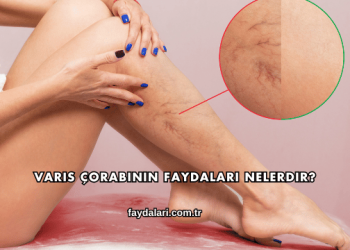 Varis Çorabının Faydaları Nelerdir?