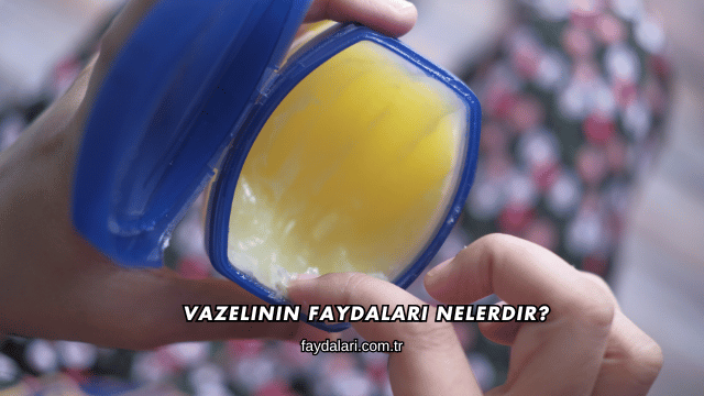Vazelinin Faydaları Nelerdir?