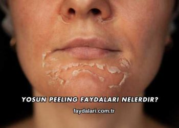 Yosun Peeling Faydaları Nelerdir?
