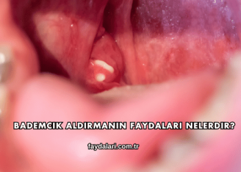Bademcik Aldırmanın Faydaları Nelerdir?