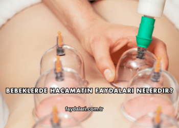 Bebeklerde Hacamatın Faydaları Nelerdir?