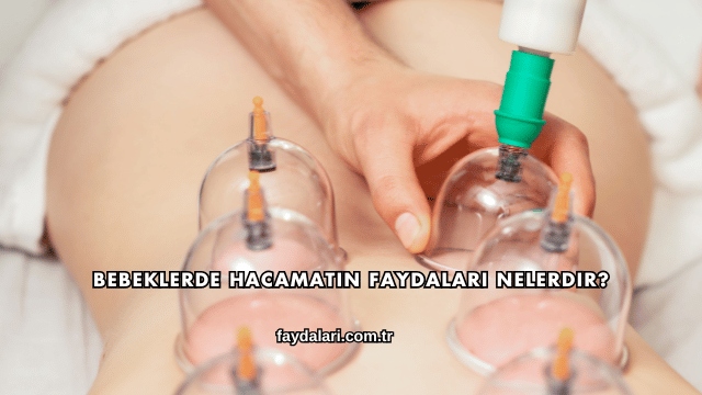 Bebeklerde Hacamatın Faydaları Nelerdir?