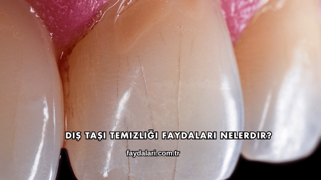 Diş Taşı Temizliği Faydaları Nelerdir?