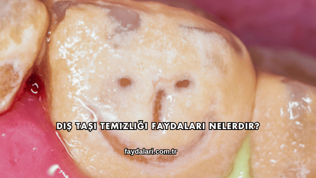 Diş Taşı Temizliği Faydaları Nelerdir?
